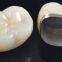 CROWNS & BRIDGES | ALL CERAMICS Zirconia Layered