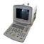 Portable Convex Ultrasound Scanner---CE certified