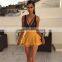 B33576A 2017 Newly Cheap mature Transparent hot women Bodysuit Lingerie