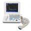 Laptop Ultrasound Machine with 3.5 Mhz convex probe by CE/ISO approved