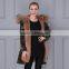 2016 Women's Winter Thick Removable Fur Collar Coat Outerwear Women Parka With Faux Fur