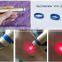 Spiritlaser ND-11 Vascular Removal Laser/acne treatment facial telangiectasis removal 980nm diode laser
