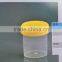 Disposable PP Material Hospital Urine Container 30ml/40ml/60ml/100ml