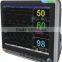 SM-500D Cheap hot sell latest patient monitor