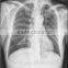in the Nsecond of 2015 Standard Medicalfilm Dry Thermal X-ray Film the Most Popular China Supplier