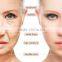 Bags Under The Eyes Removal Distributors Wanted Pigment Removal Hifu Wrinkle Removal/hifu Face Lift/portable Hifu Machine