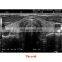Hot Sales Original Mindray DP-2200PLUS  Portable Full digital ultrasound machine /mindary ultrasound