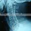 china suppliers for medical equipment,agfa film china factory, film dt2b,fuji medical x-ray film of  supplier