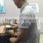liposonix weight loss body slimming machine china