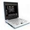 SS-6B Laptop All-Digital Ultrasound