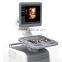 Trolley ultrasound scanner Color doppler ultrasound system (optional 4D)