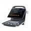 DP10 Mindray Black White Ultrasound Machine, Portable Ultrasound Machine, Mindray Ultrasound Machine