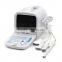 China medical factory supply Multi-frequency digital cheap price of mini ultrasound machine for pregnancy