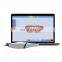MY-D072 medical device portable or trolley intraoral camera dental 3d intra oral scanner for dentist