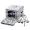 Good price Full Digital Portable Ultrasound Scanner RUS-6000D with linear transvaginal convex microconvex probe