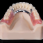 Implant dental lab China,Emax dental lab China,Zirconia dental lab China,Dental Lab China,China Dental Lab