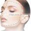 Ipl Shr Beauty Machine for hari removal and skin rejuvenation