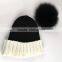 Myfur Classical Women Beanie Hat with Big Soft Real Fox Fur Pom Pom Knitting Cap