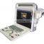 best price  scanner  handheld medical portable laptop black and white ultrasound