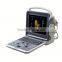 2016 new type 3d/4d ultrasound color doppler syatem for sale