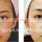 Professional 2016 Professional High Quality Fine Lines Removal Hair Removal IPL+RF E-LIGHT Machine