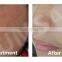 2016 New Product technology epilator pdt beauty machine skin care red light therapy portable