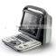 portable famous brand ultrasound machine SonoScape A6