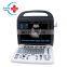 HC-A012 High resolution 15 inch LCD PW Function Ultrasound/Portable Color Doppler Ultrasound scan