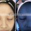 2016 Hot Selling 3D Skin Moisture and Deep Problem Scope Analyzer