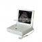 MY-A004 Hospital Sonar Ultrasound Equipment Portable Ultrasound Machine