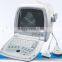 Top quality factory price portable ultra sound machine for sale