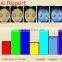 portable face skin analyzer & 3d skin scanner analyzer