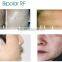 The multifunctional portable HIFU focused ultrasonic shaping body system with cellulite reduction