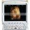 MC-DU-Q8 Portable OB/GYN 3D/4D 4d portable ultrasound machine