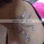 Tattoo Removal Laser Machine Q Switch Tattoo Removal Mongolian Spots Removal Machine/nd Yag Long Pulse Laser Telangiectasis Treatment