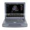 Factory Price China Portable Color Doppler Ultrasound Machine 4D 15 inch Led Monitor with A Big Discount