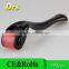 Professional 540 Titanium Alloy Needle Derma Roller,derma Roller Mirconeedle Skin Roller, Beauty Roller Scar Treatment 1.5mm