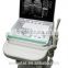 V7 Laptop Ultrasound Scanner