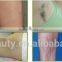 532nm 1064nm Long Pulse Q Switch Nd Yag Laser Hair Removal Machine/permanent Hair Removal Hori Naevus Removal
