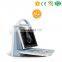 MY-A027A 2D Full digital color doppler system Portable ultrasound machine price
