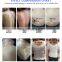 cavitation rf machine 80k cavitation slimming machine laser  body cavitation