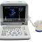 Sale portable Ultrasound Scanner with Convex probe for detecting gynecology obstetrics etc
