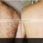 High efficient ipl hair removal /IPL for skin rejuvenation with CE approval