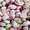 Round shape light speckled kidney bean