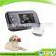 CE*ISO approved Handheld Veterinary Ultrasound Machine vet with Convex Probe V8 for animal vet