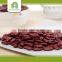 import export business opportunity red kidney beans import