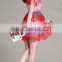 T-D069 Summer New Arrival Casual Trend Lace Contrast Color Women Dress