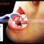 New item Autoclavable dental mirror/dental mouth mirror