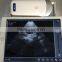 Excellent Wireless Ultrasound Probe type Ultrasound Scanner -WBU01