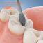 Dental Diamond Burs for dental surgeries polishing miya@moresuperhard.com